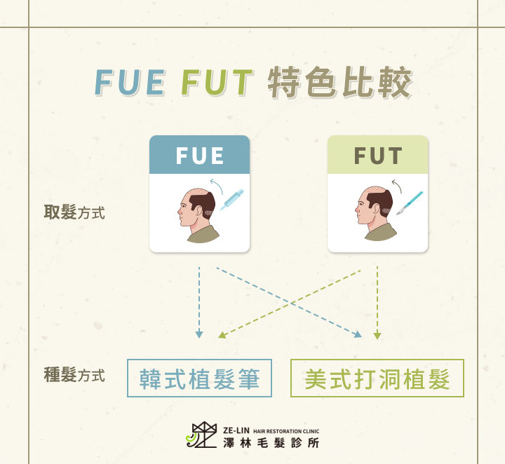 FUE FUT 特色比較