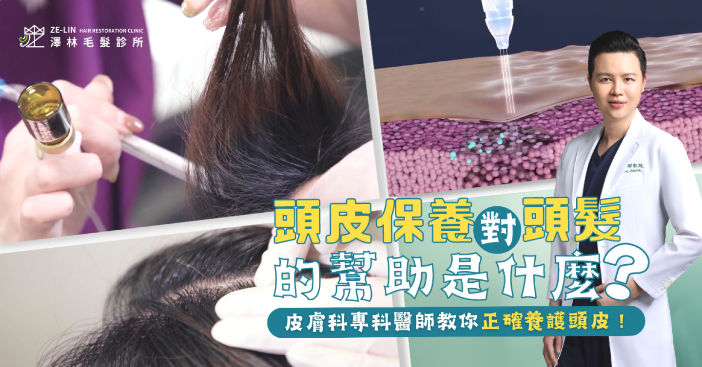 頭皮保養怎麼做