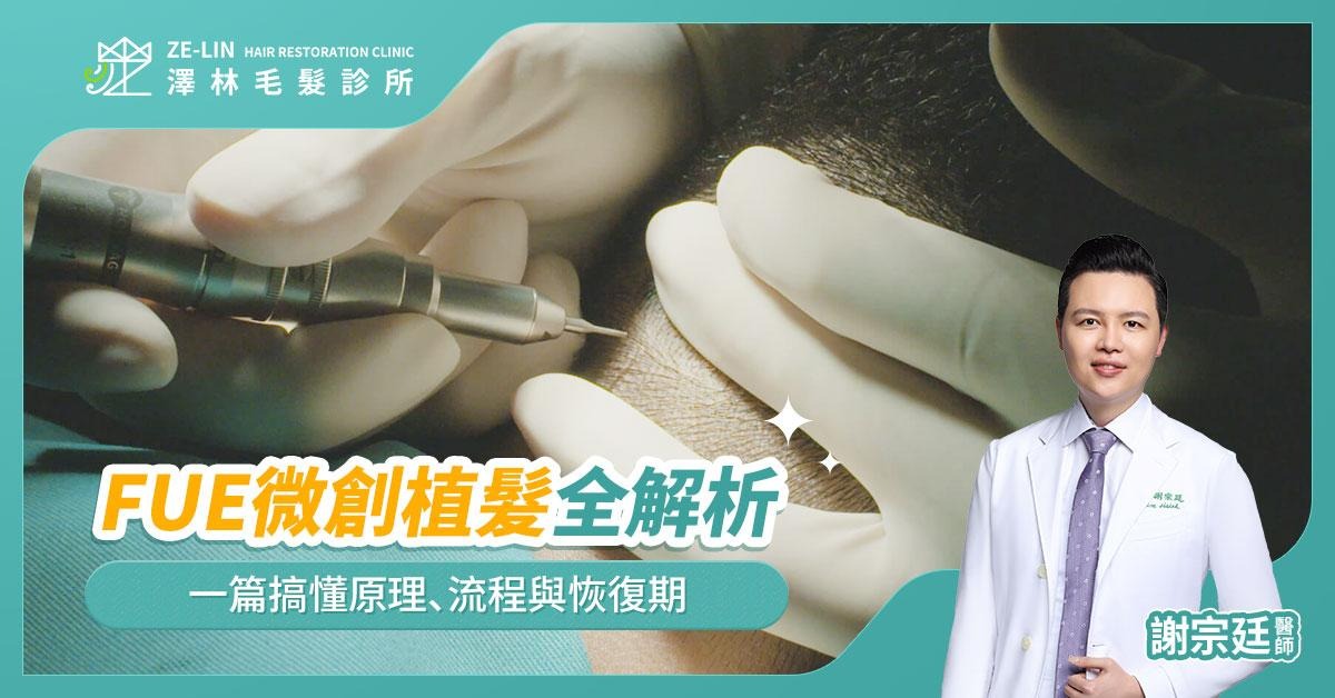 高額頭植髮！女生髮際線植髮案例分享