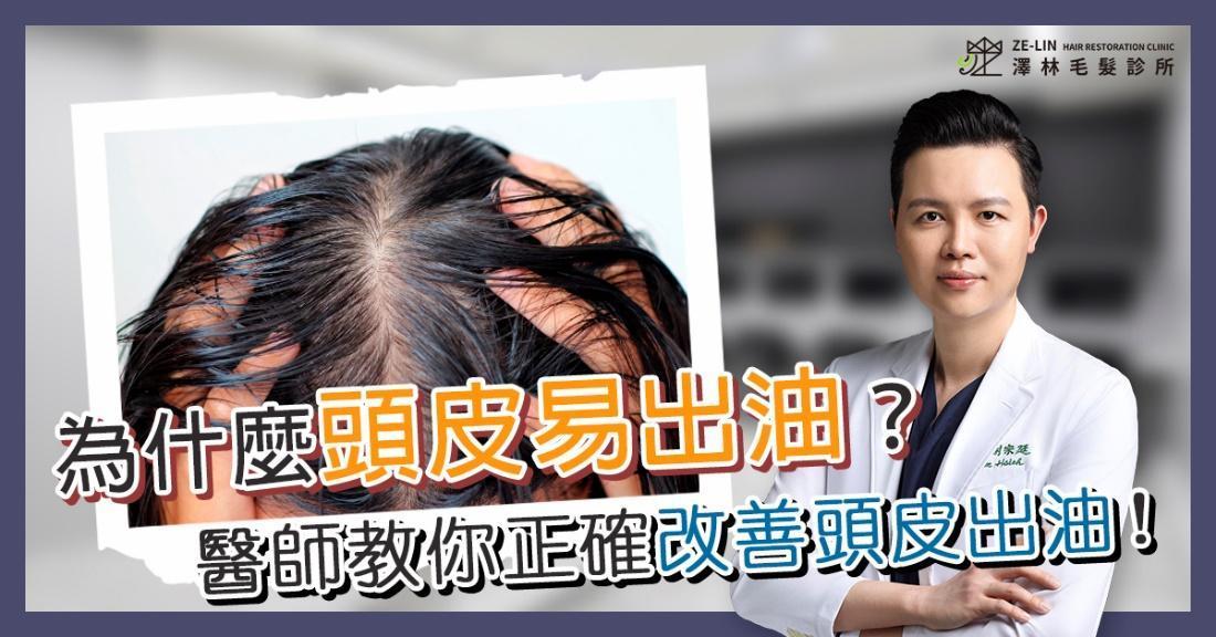 頭皮出油怎麼辦?讓皮膚科醫師教你改善頭皮出油