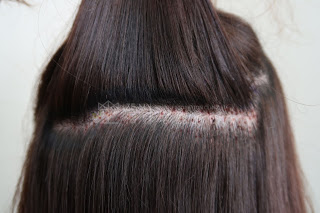 免剃髮FUE鑽取毛囊