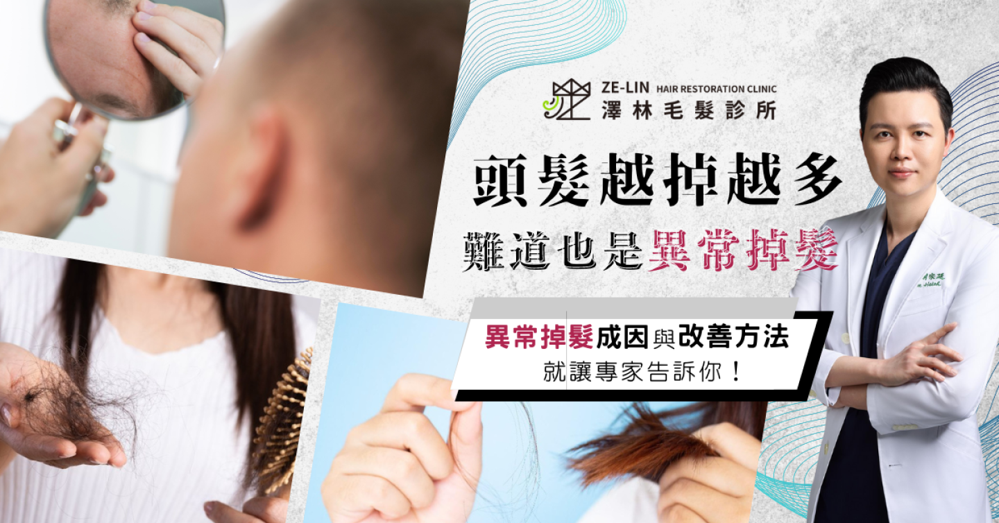 異常掉髮怎麼辦?醫師解析掉髮原因和治療方法