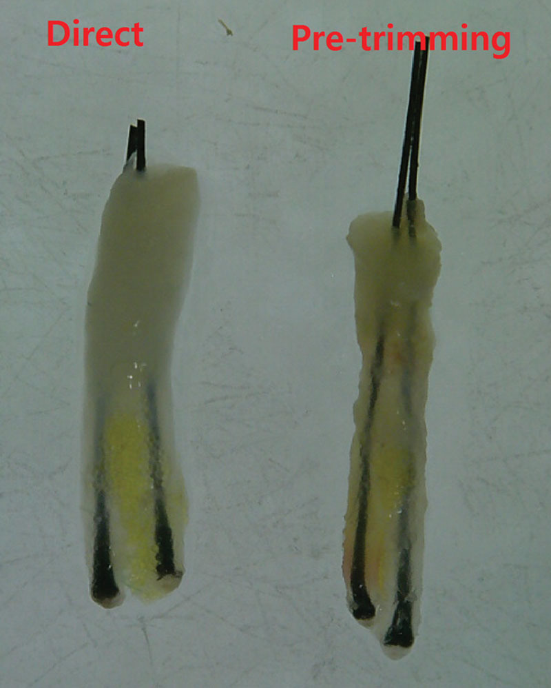 免剃髮植髮鑽取毛囊