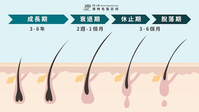 頭髮生長週期發生變化，可能導致異常掉髮