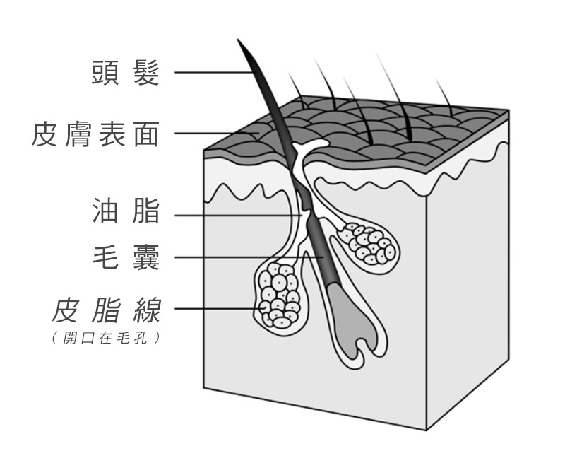 頭皮出油示意圖