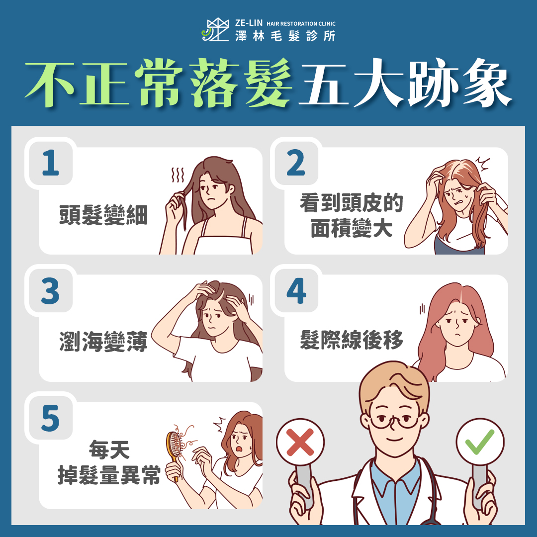 掌握髮量減少的5個跡象