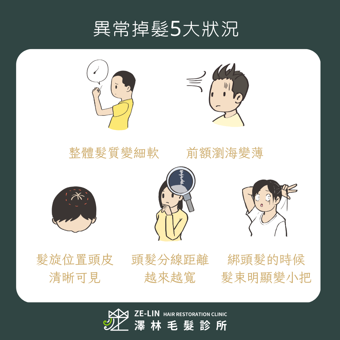 常見的5大異常掉髮狀況