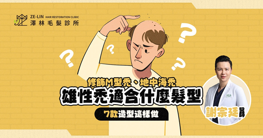 雄性禿髮型如何修飾？