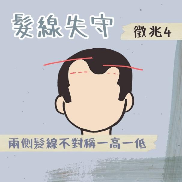 髮線失守徵兆4:左右兩側髮際線有高低落差