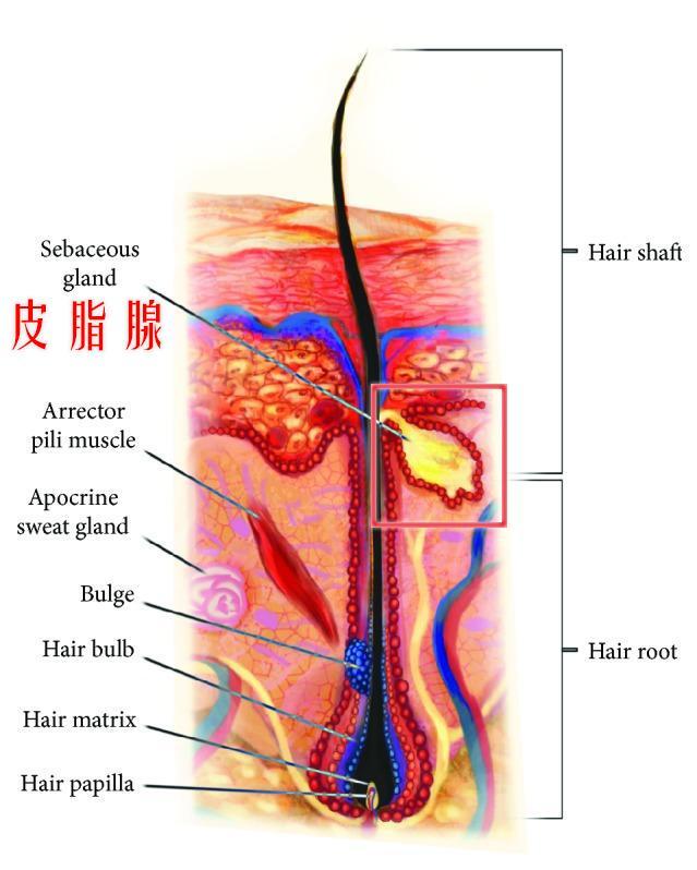皮脂腺是毛囊的附屬器官，分泌油脂排出到頭皮，引起頭皮出油。