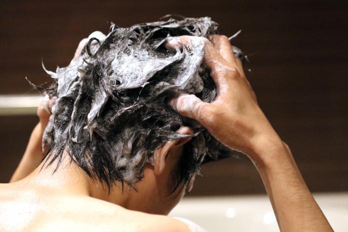 藥用洗髮精可以治療脂漏性皮膚炎