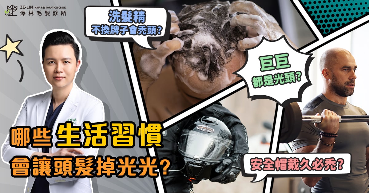 髮際線後退怎麼辦?皮膚科醫師為你解答